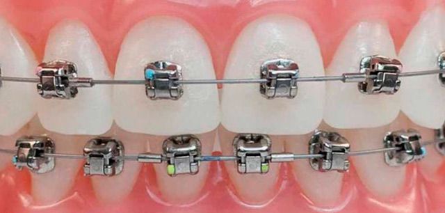 A & C Puche Clínica Dental ortodoncia